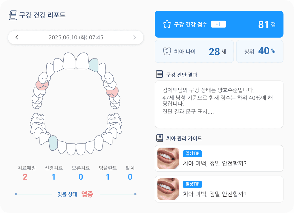 AI Oral Health Analysis