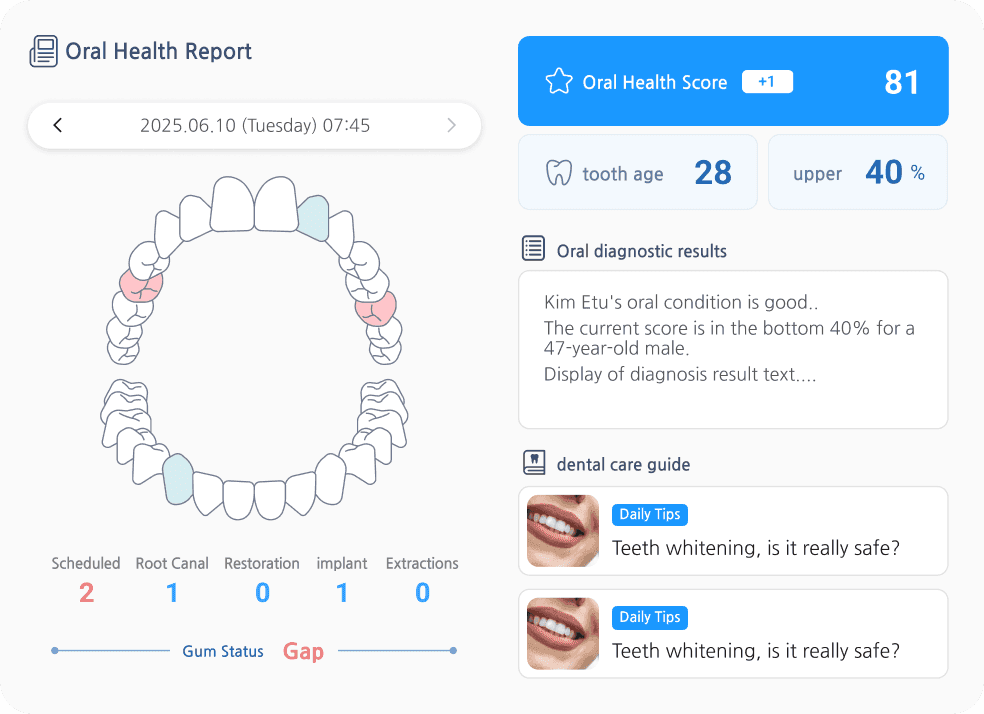 AI Oral Health Analysis
